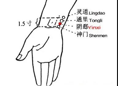 睡覺愛出汗，艾灸這幾個穴位