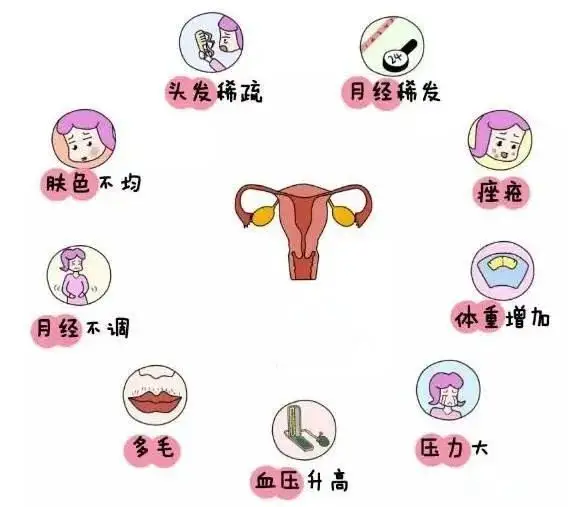 10個(gè)女人就有1個(gè)患多囊！被它纏上不要怕，艾灸幫你調(diào)“多囊”！